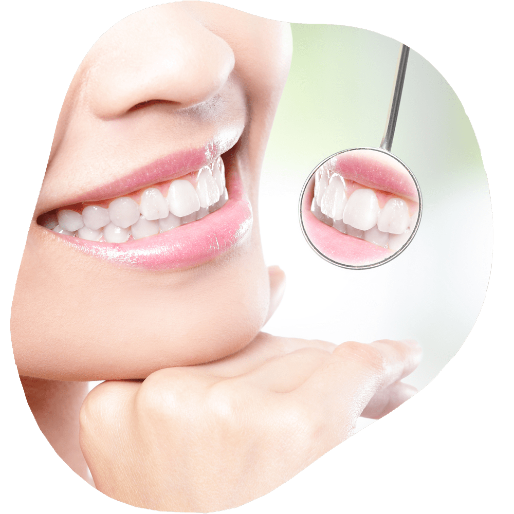 Cleaning and Preventative Care | Toothville Family Dentistry | NW Calgary | General Dentist