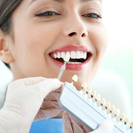 Dental Veneers | Toothville Family Dentistry | NW Calgary | General Dentist