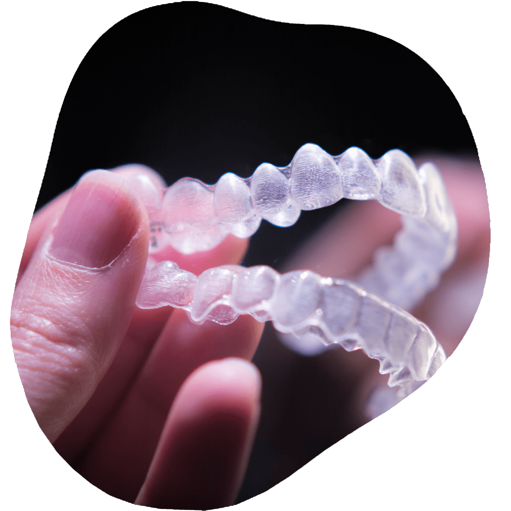 Invisalign | Toothville Family Dentistry | NW Calgary | General Dentist