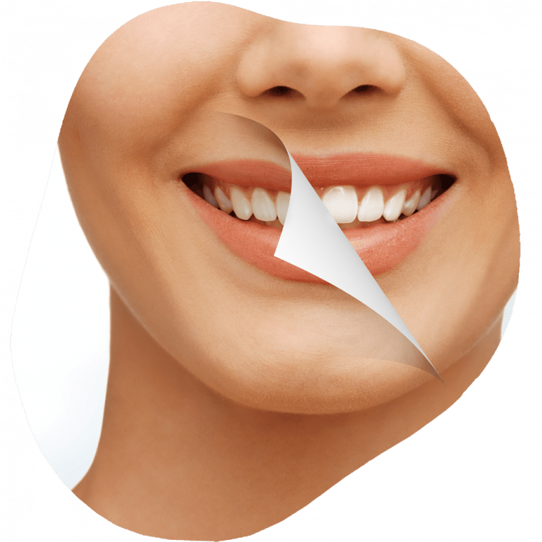 whitening nw