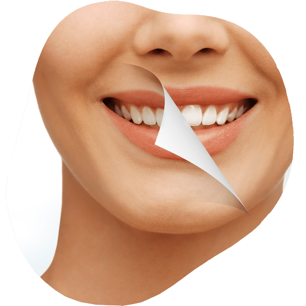 Teeth Whitening | Toothville Family Dentistry | NW Calgary | General Dentist