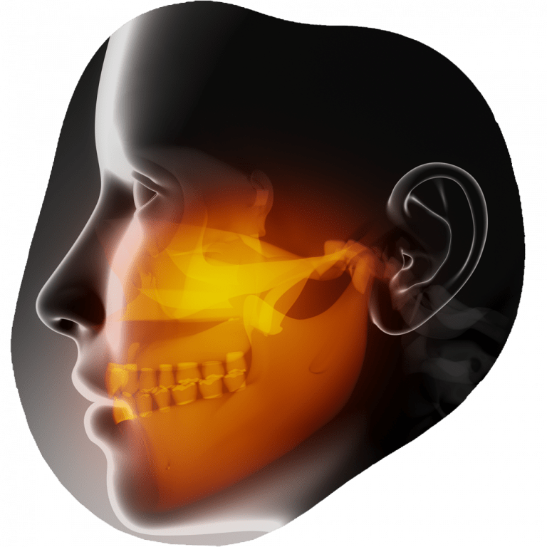 Jaw Pain, Bruxism & TMJ Toothville Family Dentistry NW Calgary