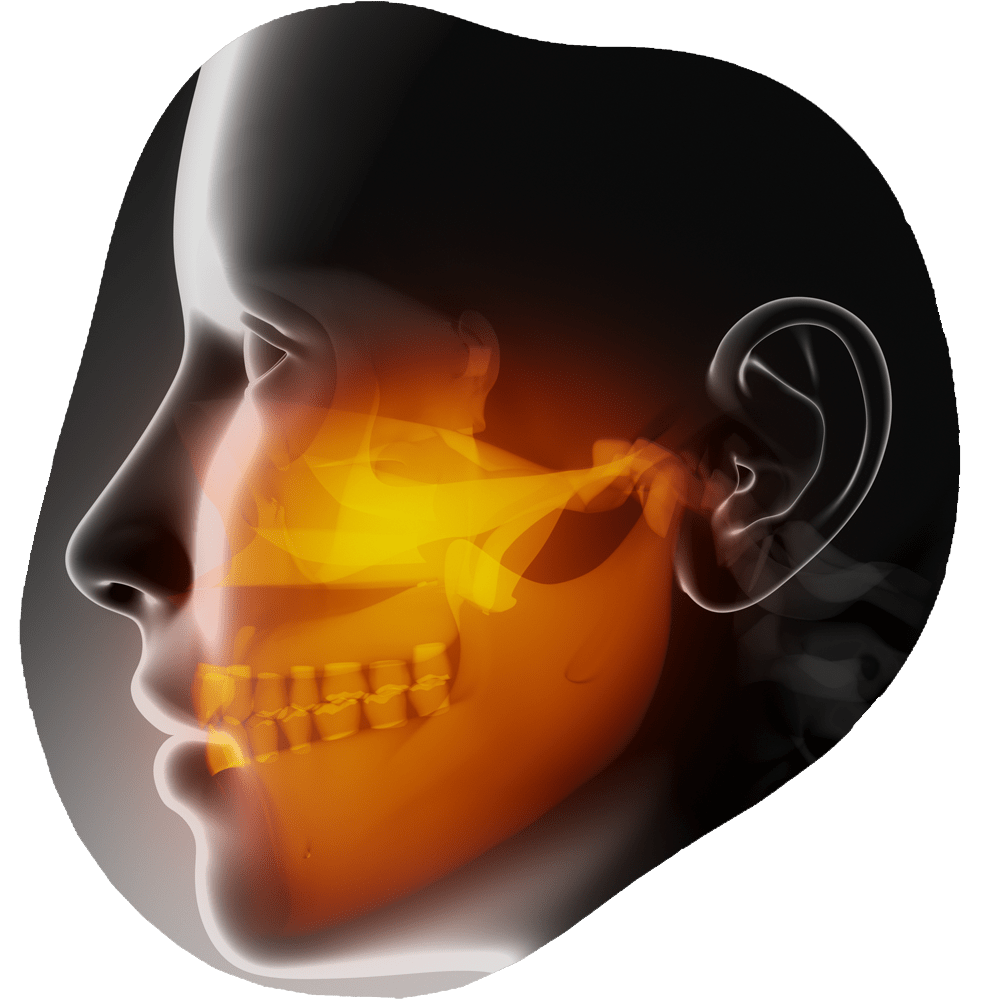 TMJ & Bruxism | Toothville Family Dentistry | NW Calgary | General Dentist