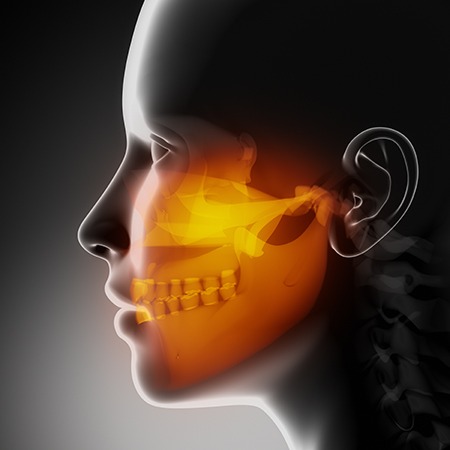 Jaw Pain, Bruxism and TMJ | Toothville Family Dentistry | NW Calgary | General Dentist